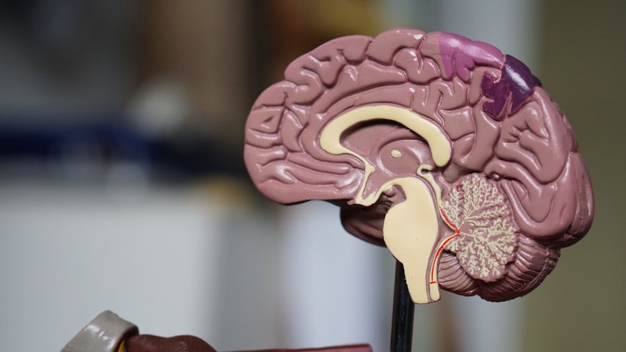 brain health